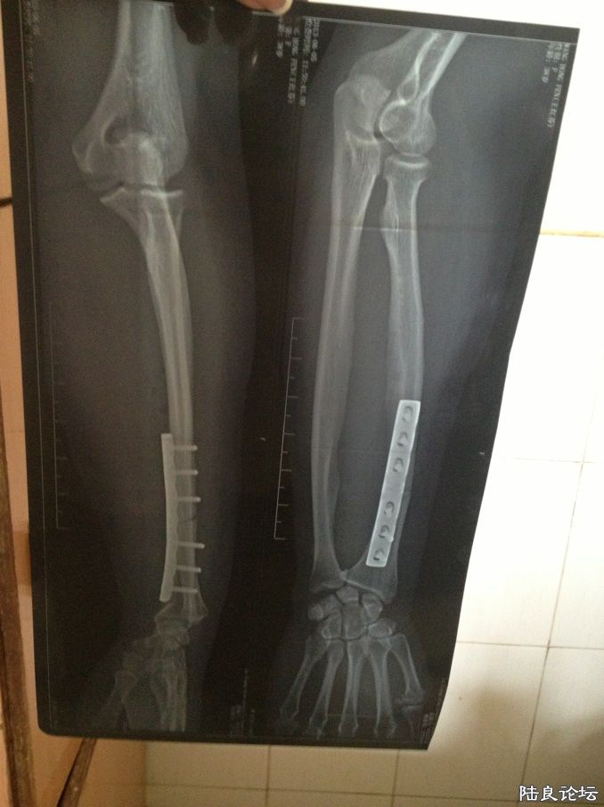 ���ڴ��Ÿ���