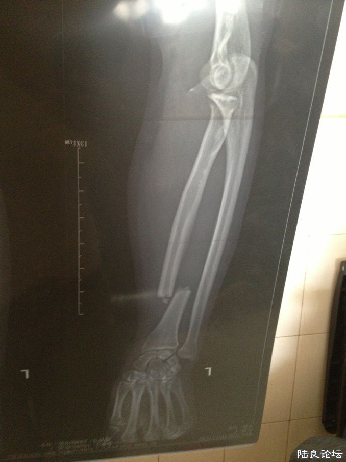 ��ʱƬ�Ӿ���ʾ������