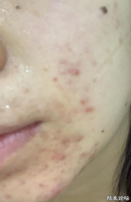 ͻ���Զ���