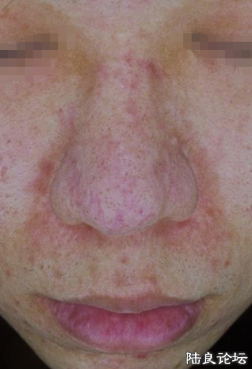 ������̶���+����������