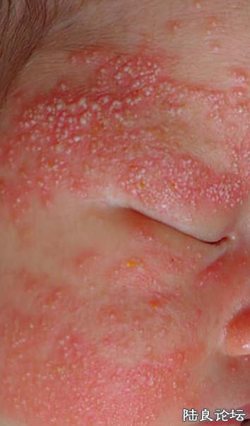 Ӥ��������